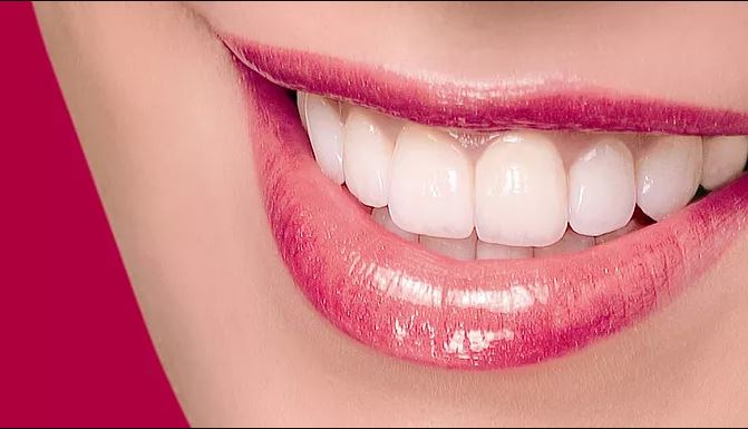 Lựa chọn loại răng sứ nào để bọc răng sứ