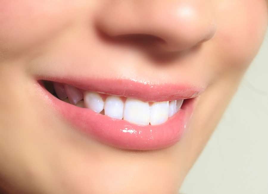 Quy trình bọc răng sứ được thực hiện ra sao?