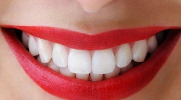 Bọc răng sứ nguyên hàm giá bao nhiêu tại Đồng Nai?