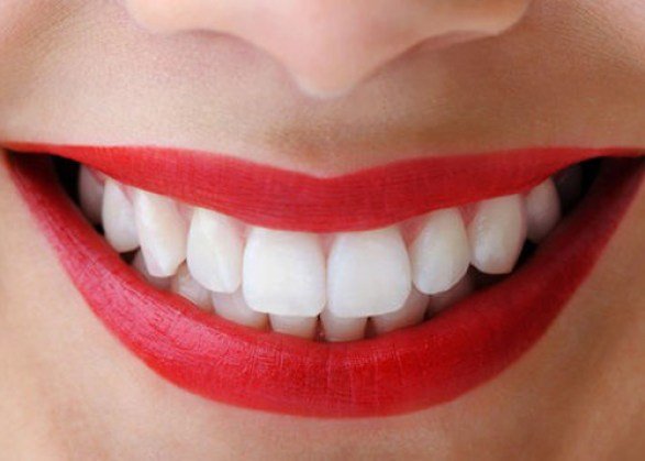 Bọc răng sứ nguyên hàm giá bao nhiêu tại Đồng Nai?